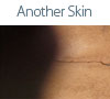 another skin